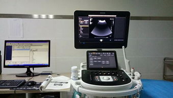 旬陽縣醫(yī)院成功引進(jìn)先進(jìn)超聲設(shè)備，正式開通新生兒顱腦超聲檢查服務(wù)